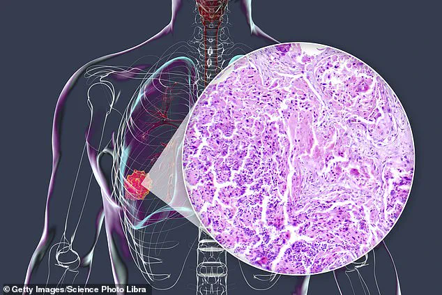 New Polymorph of 40-Year-Old Antiparasitic Drug Shows Cancer Treatment Potential