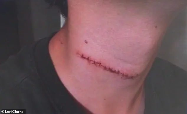 Daytona Family in Shock After Teen Slashed in Random Attack